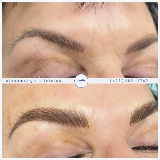 full brows clinic
